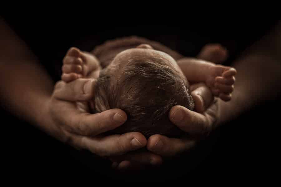 Der Milchschorf – Schuppen auf Babys Kopf