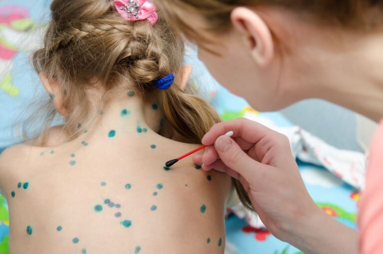 Hautkrankheiten bei Kindern: Neurodermitis, Schuppenflechte und Co.