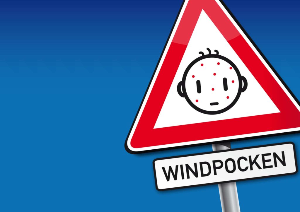 Die Windpocken