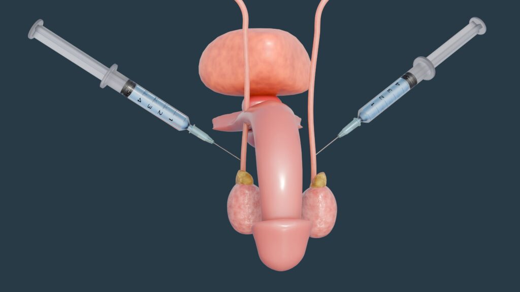 Vasektomie grafisches Schaubild