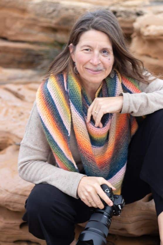 Michaela Grönnebaum kämpfte jahrelang mit ihrem Selbstbild aufgrund eines Blutschwamms in ihrem Gesicht.